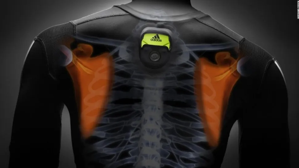 Adidas fitness wearable — sports apparel giant's wrist-worn sensor following the $239m Runtastic acquisition